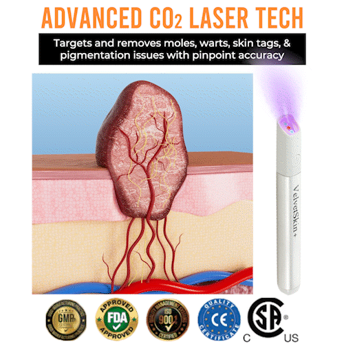 🔥 NEW 2026 GEN 2 Update☂Pafrix® VelvetSkin+ Photorejuvenation2.0 ⚔️All-in-One Laser Eraser Pen🖊️ (🔬Powered by Photorejuvenation – effectively removes moles, warts, skin tags, pigmentation spots, and other skin imperfections)