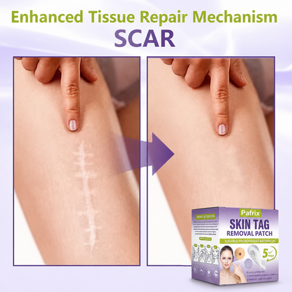 Pafrix® Soluble Microneedle Botanical Skin Tag Removal Patch