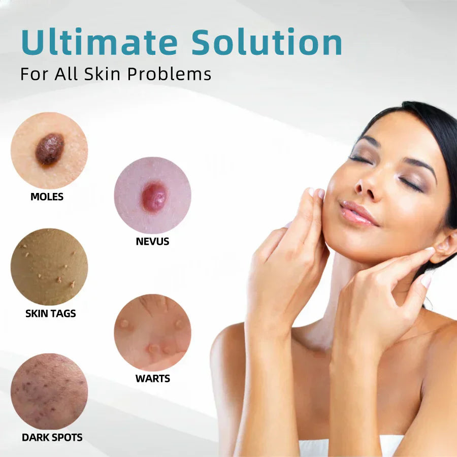 🔥 NEW 2026 GEN 2 Update☂Pafrix® VelvetSkin+ Photorejuvenation2.0 ⚔️All-in-One Laser Eraser Pen🖊️ (🔬Powered by Photorejuvenation – effectively removes moles, warts, skin tags, pigmentation spots, and other skin imperfections)