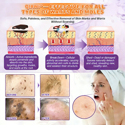 🔥Final 3 Hours 50% OFF - Natravor® Biotin 10-in-1 Skin Restoration Cream