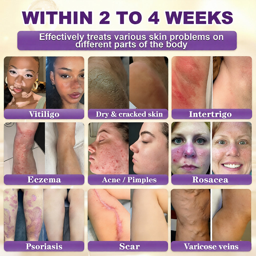 🔥Final 3 Hours 50% OFF - Natravor® Biotin 10-in-1 Skin Restoration Cream