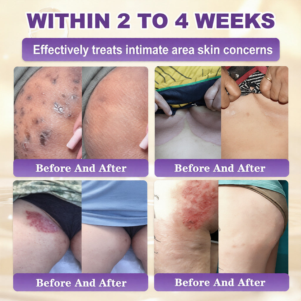 🔥Final 3 Hours 50% OFF - Natravor® Biotin 10-in-1 Skin Restoration Cream