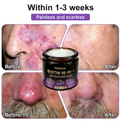 🔥Final 3 Hours 50% OFF - Natravor® Biotin 10-in-1 Skin Restoration Cream