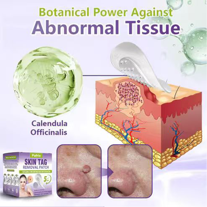 Pafrix® Soluble Microneedle Botanical Skin Tag Removal Patch