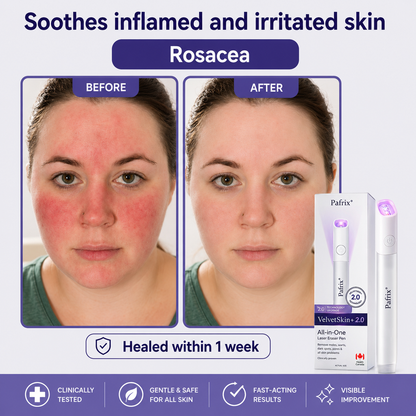 🔥 NEW 2026 GEN 2 Update☂Pafrix® VelvetSkin+ Photorejuvenation2.0 ⚔️All-in-One Laser Eraser Pen🖊️ (🔬Powered by Photorejuvenation – effectively removes moles, warts, skin tags, pigmentation spots, and other skin imperfections)