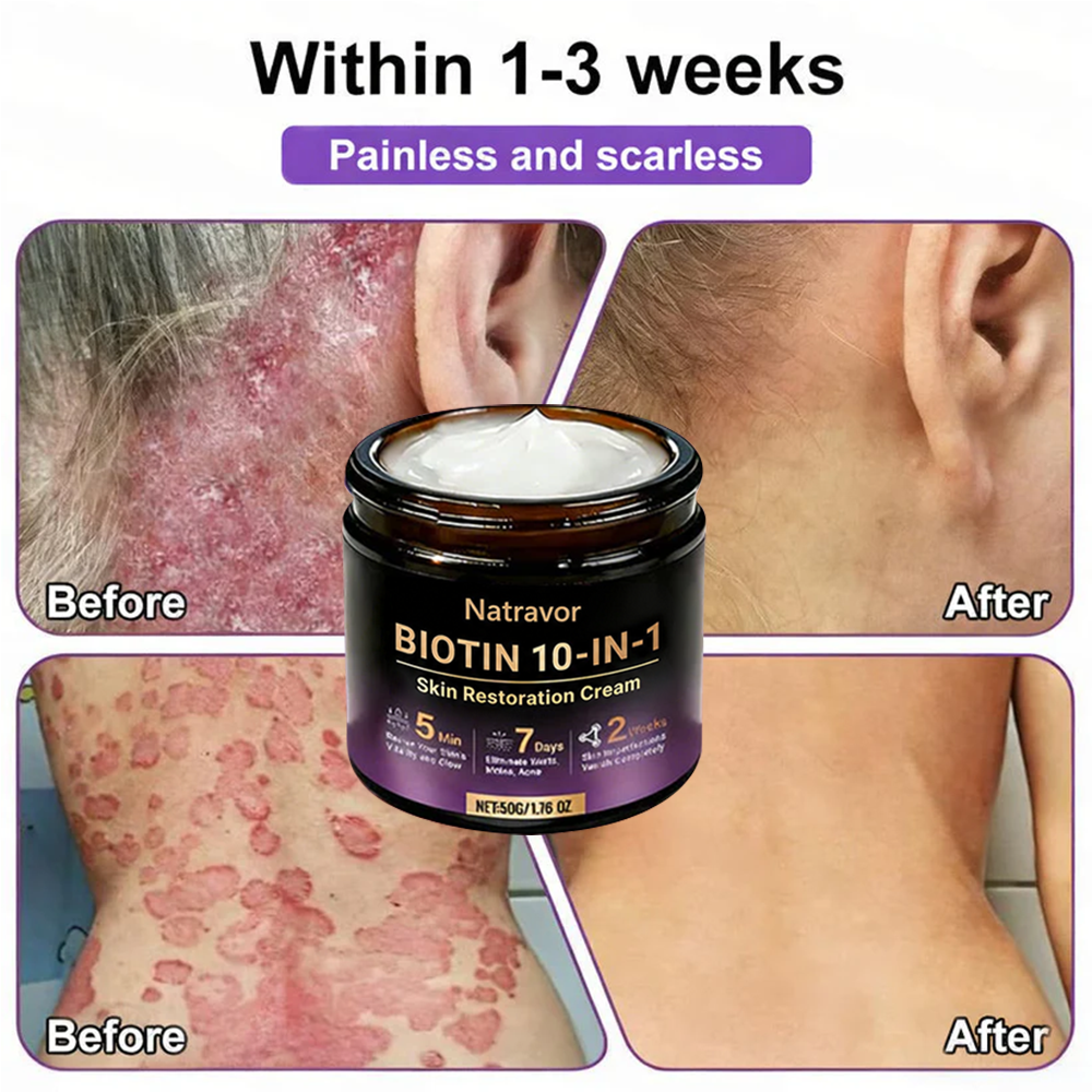 🔥Final 3 Hours 50% OFF - Natravor® Biotin 10-in-1 Skin Restoration Cream