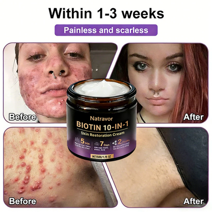 🔥Final 3 Hours 50% OFF - Natravor® Biotin 10-in-1 Skin Restoration Cream
