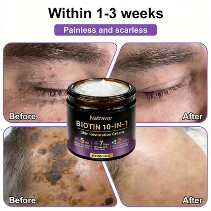 🔥Final 3 Hours 50% OFF - Natravor® Biotin 10-in-1 Skin Restoration Cream