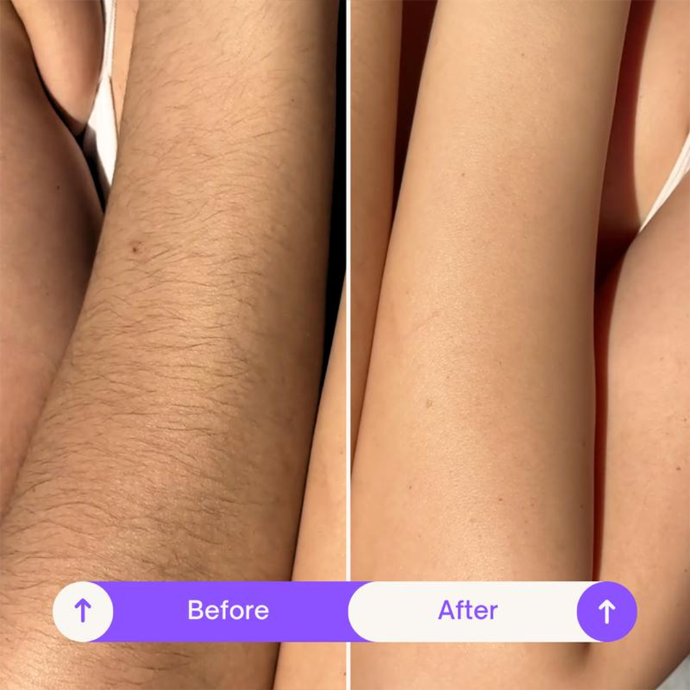 Natravor Hair Removal Cream Duo - Designed for Sensitive Skin