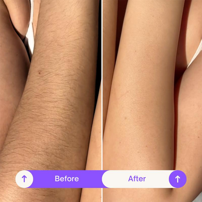 Natravor Hair Removal Cream Duo - Designed for Sensitive Skin