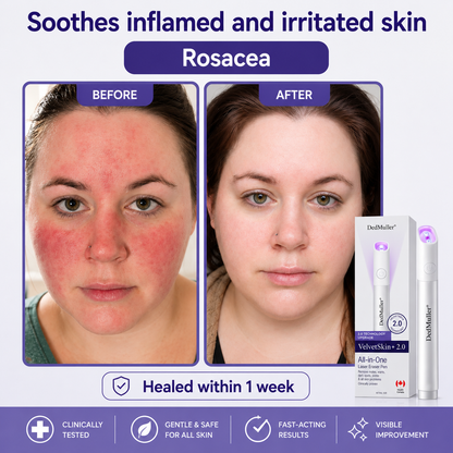 🔥 NEW 2026 GEN 2 Update☂Pafrix® VelvetSkin+ Photorejuvenation2.0 ⚔️All-in-One Laser Eraser Pen🖊️ (🔬Powered by Photorejuvenation – effectively removes moles, warts, skin tags, pigmentation spots, and other skin imperfections)