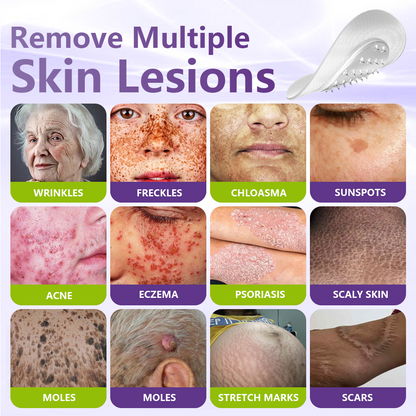 Pafrix® Soluble Microneedle Botanical Skin Tag Removal Patch