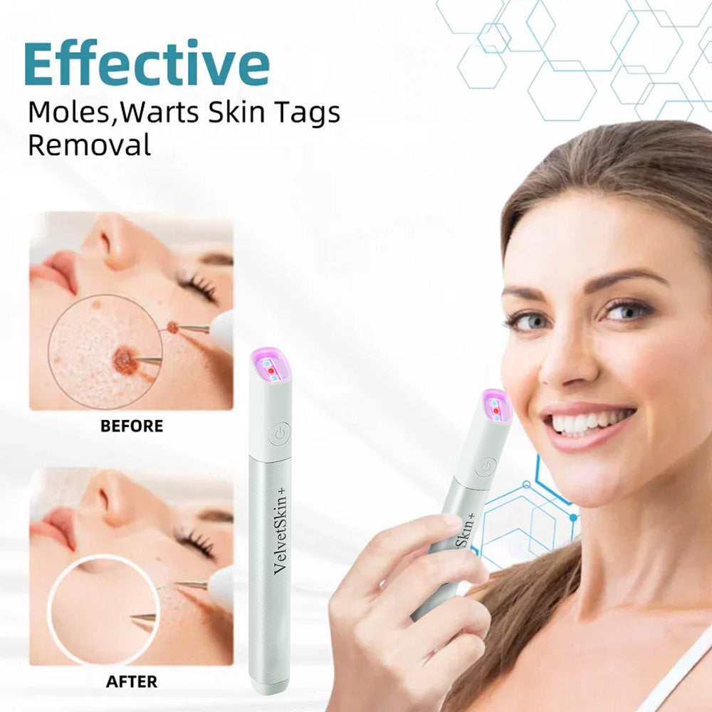 🔥 NEW 2026 GEN 2 Update☂Pafrix® VelvetSkin+ Photorejuvenation2.0 ⚔️All-in-One Laser Eraser Pen🖊️ (🔬Powered by Photorejuvenation – effectively removes moles, warts, skin tags, pigmentation spots, and other skin imperfections)