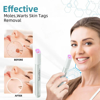 🔥 NEW 2026 GEN 2 Update☂Pafrix® VelvetSkin+ Photorejuvenation2.0 ⚔️All-in-One Laser Eraser Pen🖊️ (🔬Powered by Photorejuvenation – effectively removes moles, warts, skin tags, pigmentation spots, and other skin imperfections)